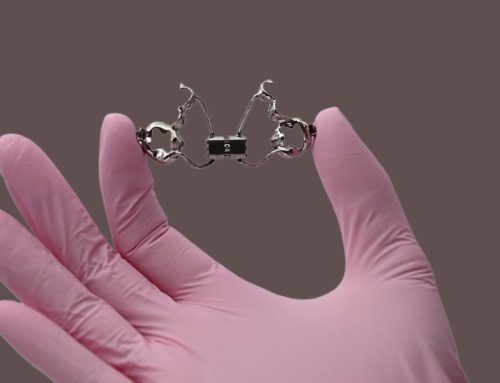 RME (Rapid Maxillary Expander)